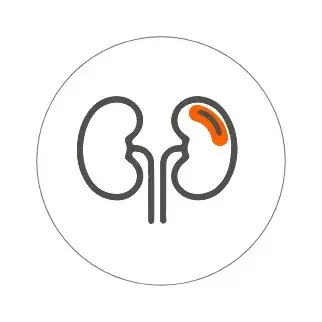 Evacutation Evacutation